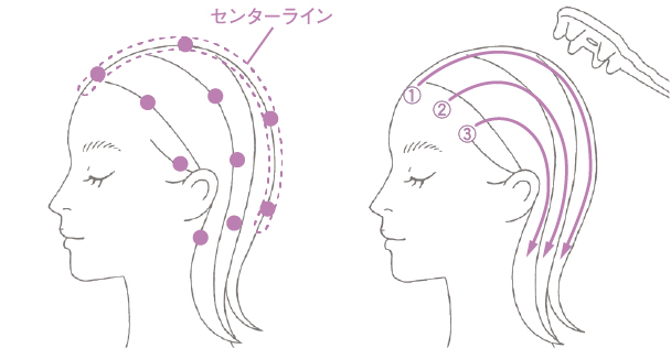 ビカッサヘッドプレートα 人図1