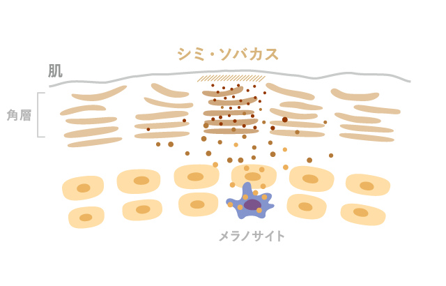 シミ・ソバカスがある肌